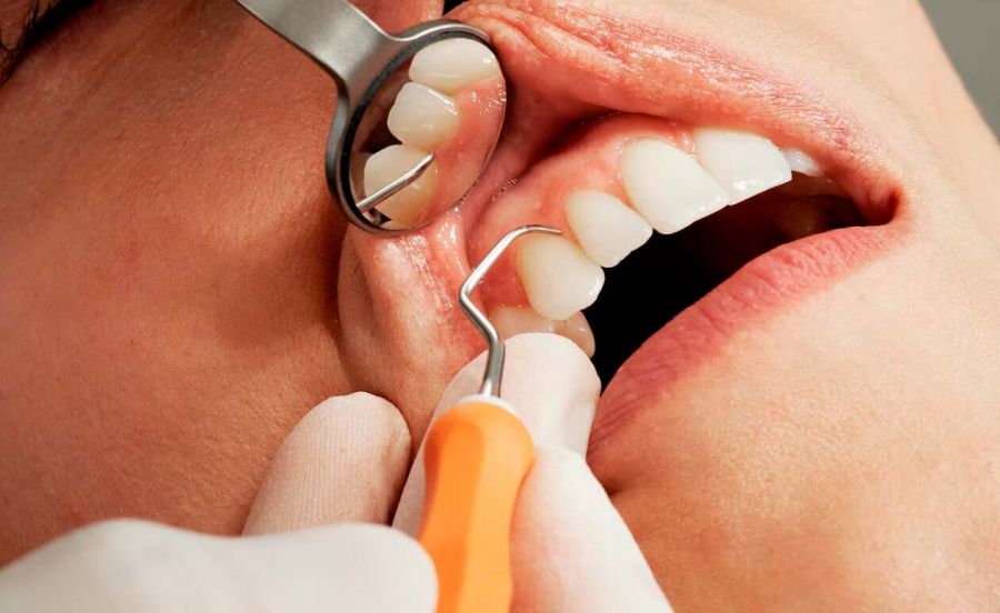 periodoncia