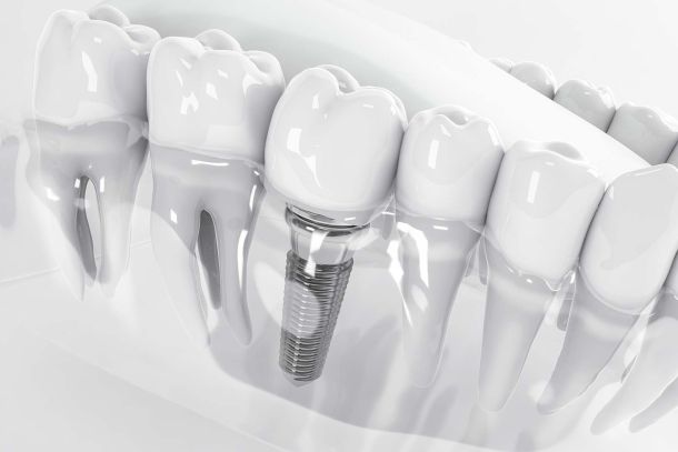 dentista sant cugat